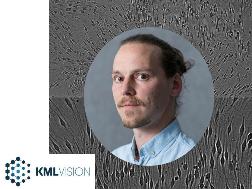 Latest insights into neuroregeneration - David Hercher interviewed by KML Vision